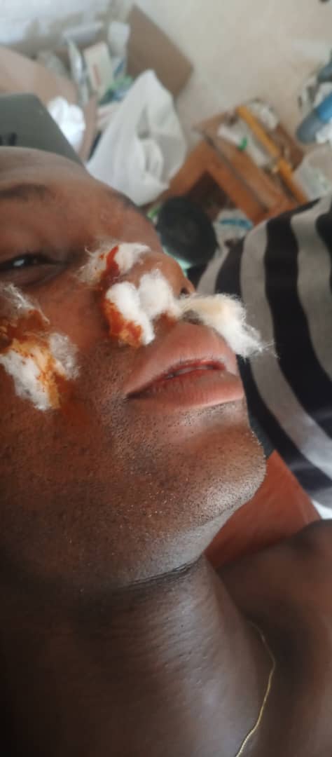 A wounded Amotekun Personnel